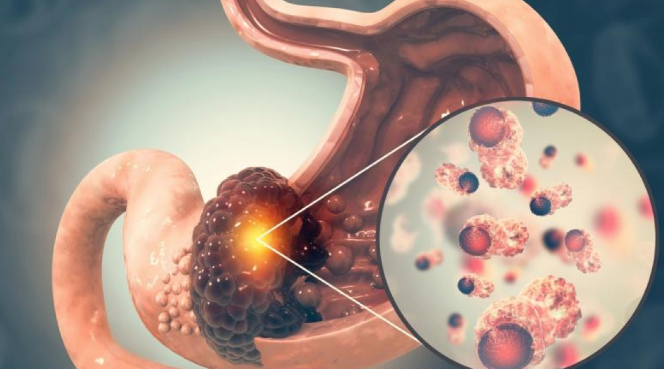 Conoce cómo mejorar tu salud intestinal